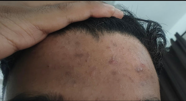 Before treatment result image