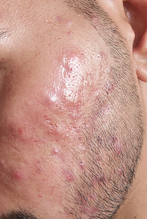 Before treatment result image