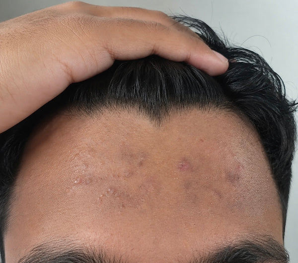 After treatment result image
