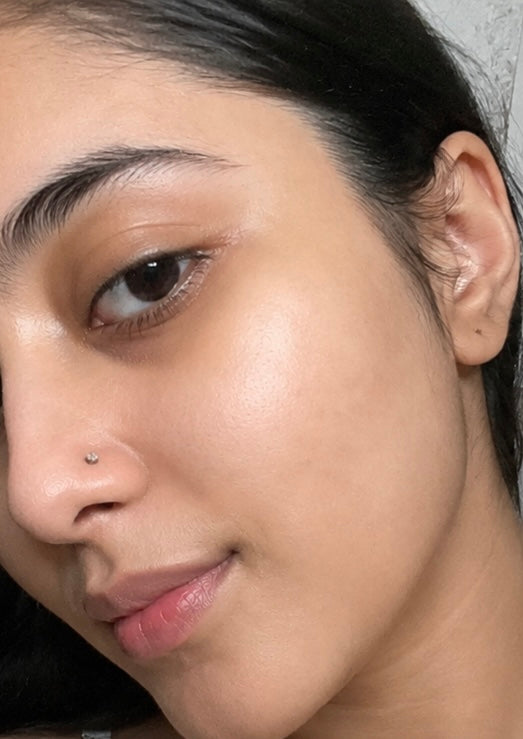 Before treatment result image
