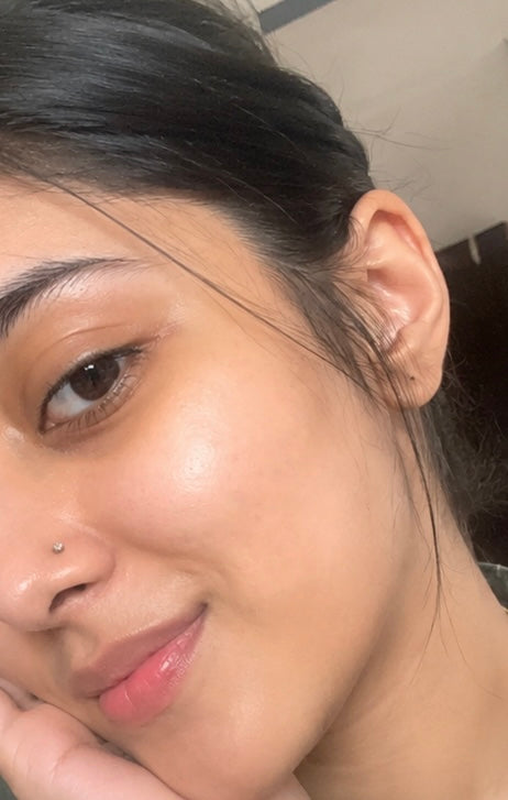 After treatment result image