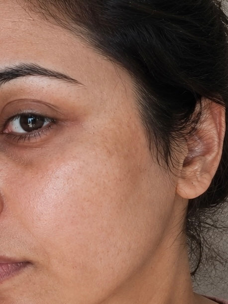 Before treatment result image