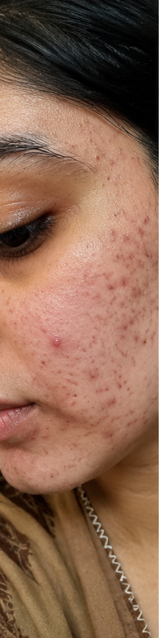 Before treatment result image