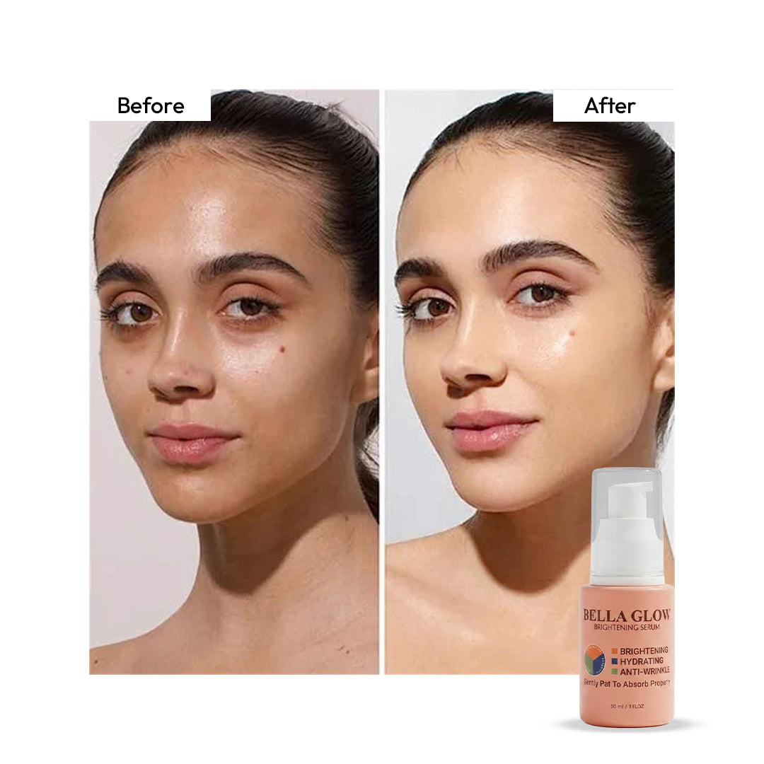 Brightening Serum for Dark Spots & Glowing Skin