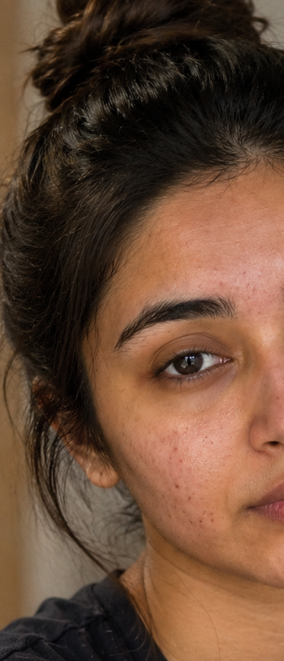 Before treatment result image
