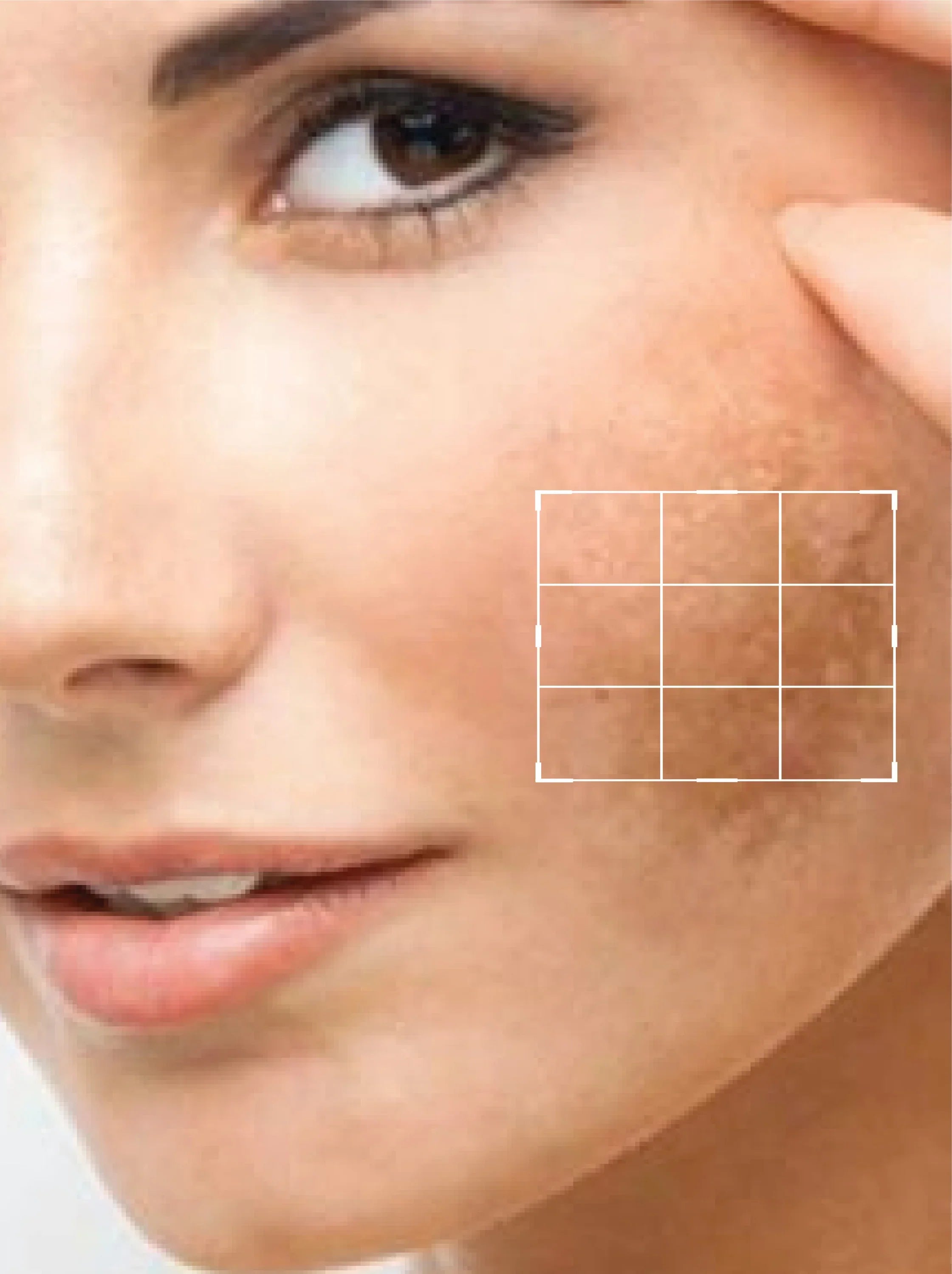 Melasma & Anti-Pigmentation