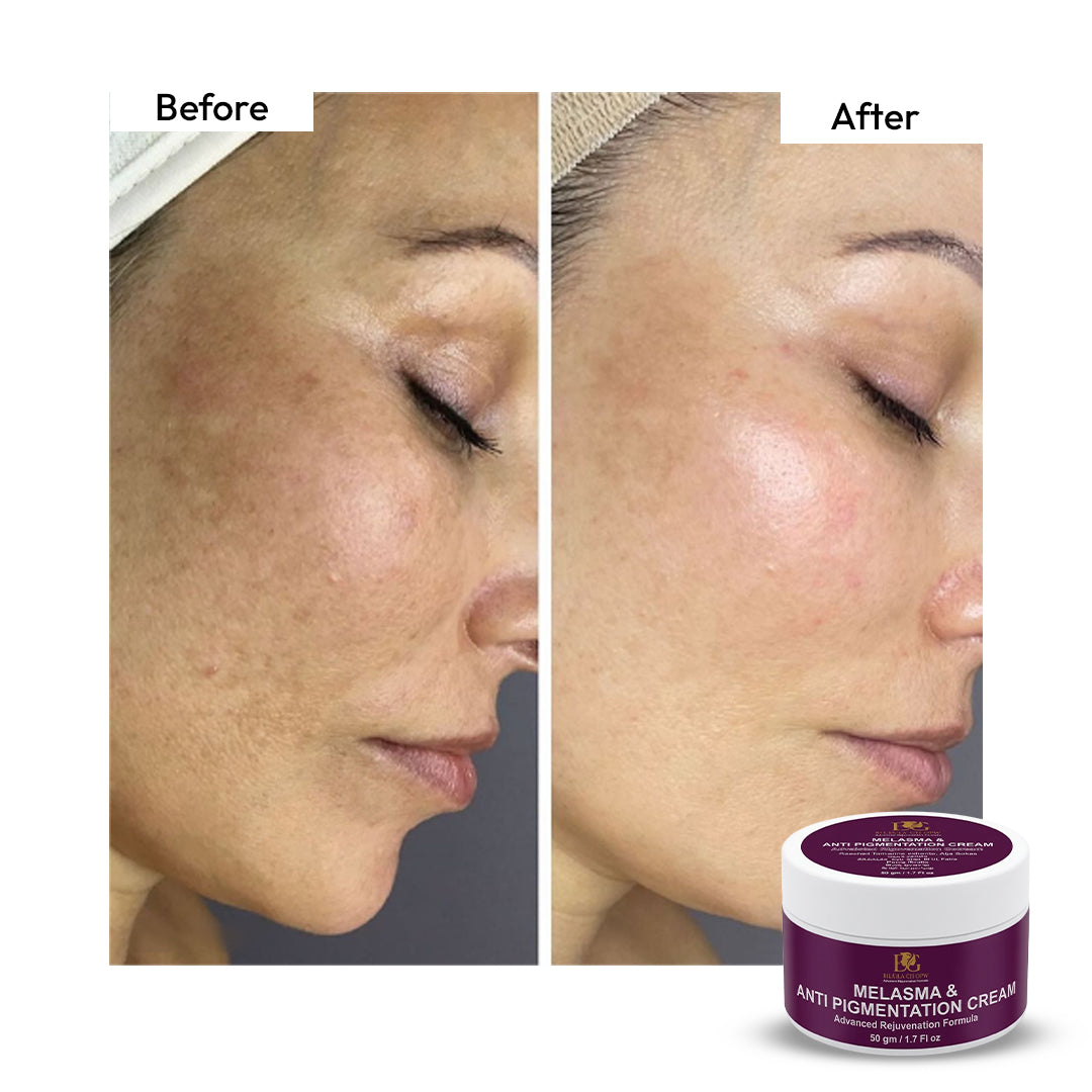 Retinol Cream for Dark Spots, Pigmentation & Uneven Skin Tone